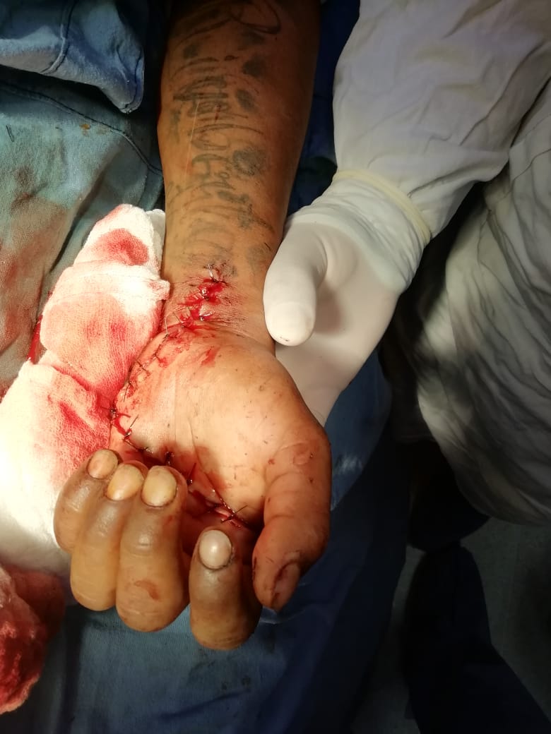 Realizan cirugía exitosa en Hospital de Putla Villa de Guerrero