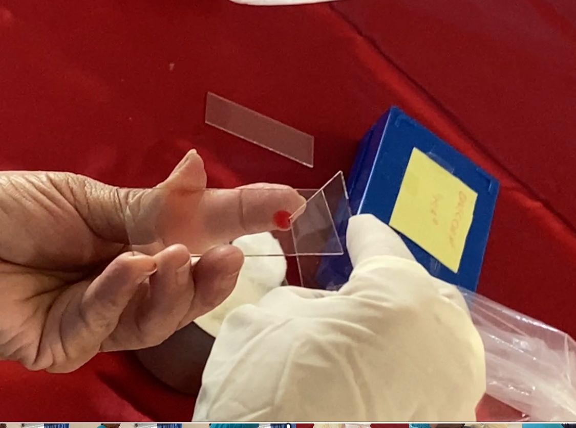 Refuerzan los SSO acciones contra el paludismo en la entidad