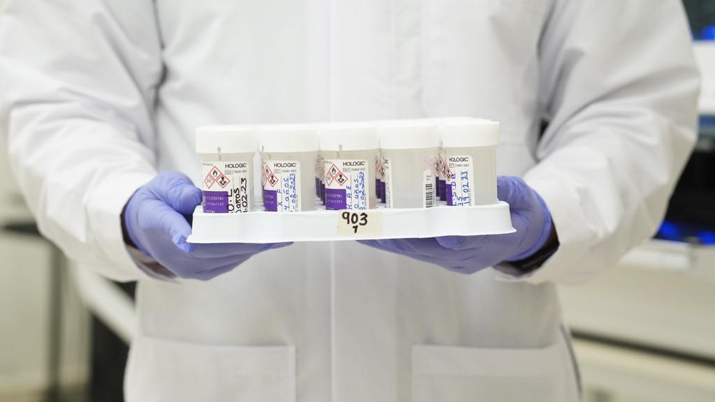 Avanza Oaxaca en detección oportuna de casos de VPH en mujeres y hombres trans