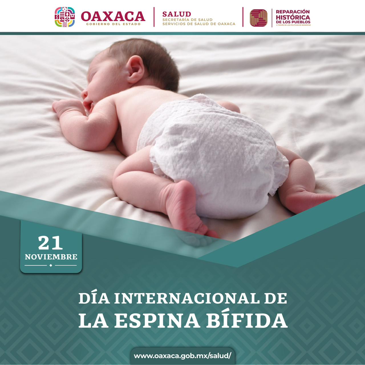 Ausencia de ácido fólico en la gestación puede causar espina bífida en recién nacidos: SSO
