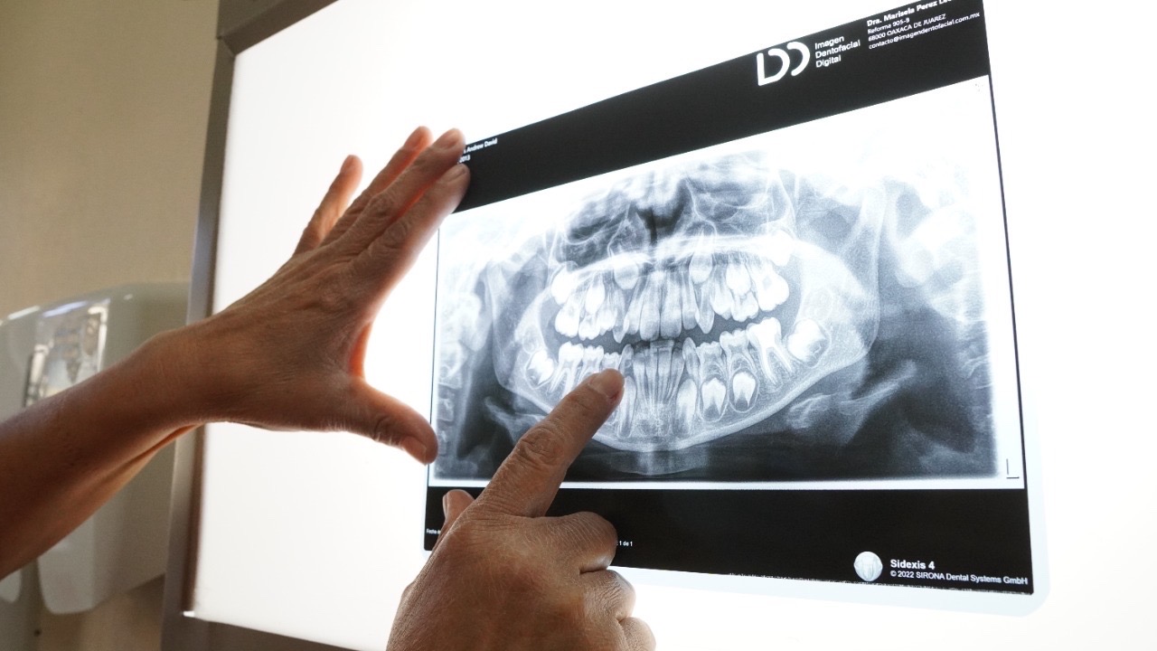 Prevención, herramienta eficaz para mantener una boca saludable