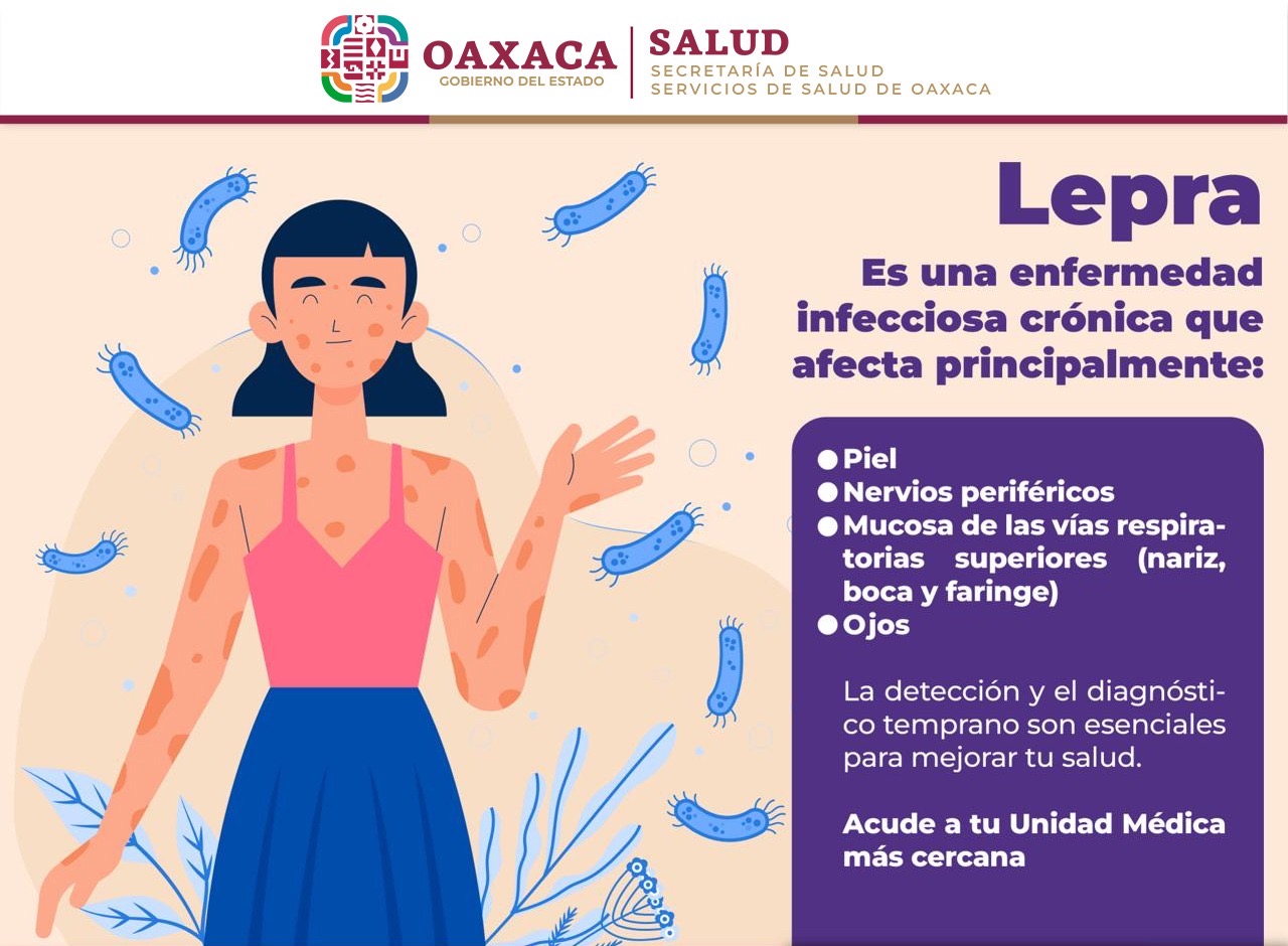 La lepra es prevenible y puede curarse con tratamiento
