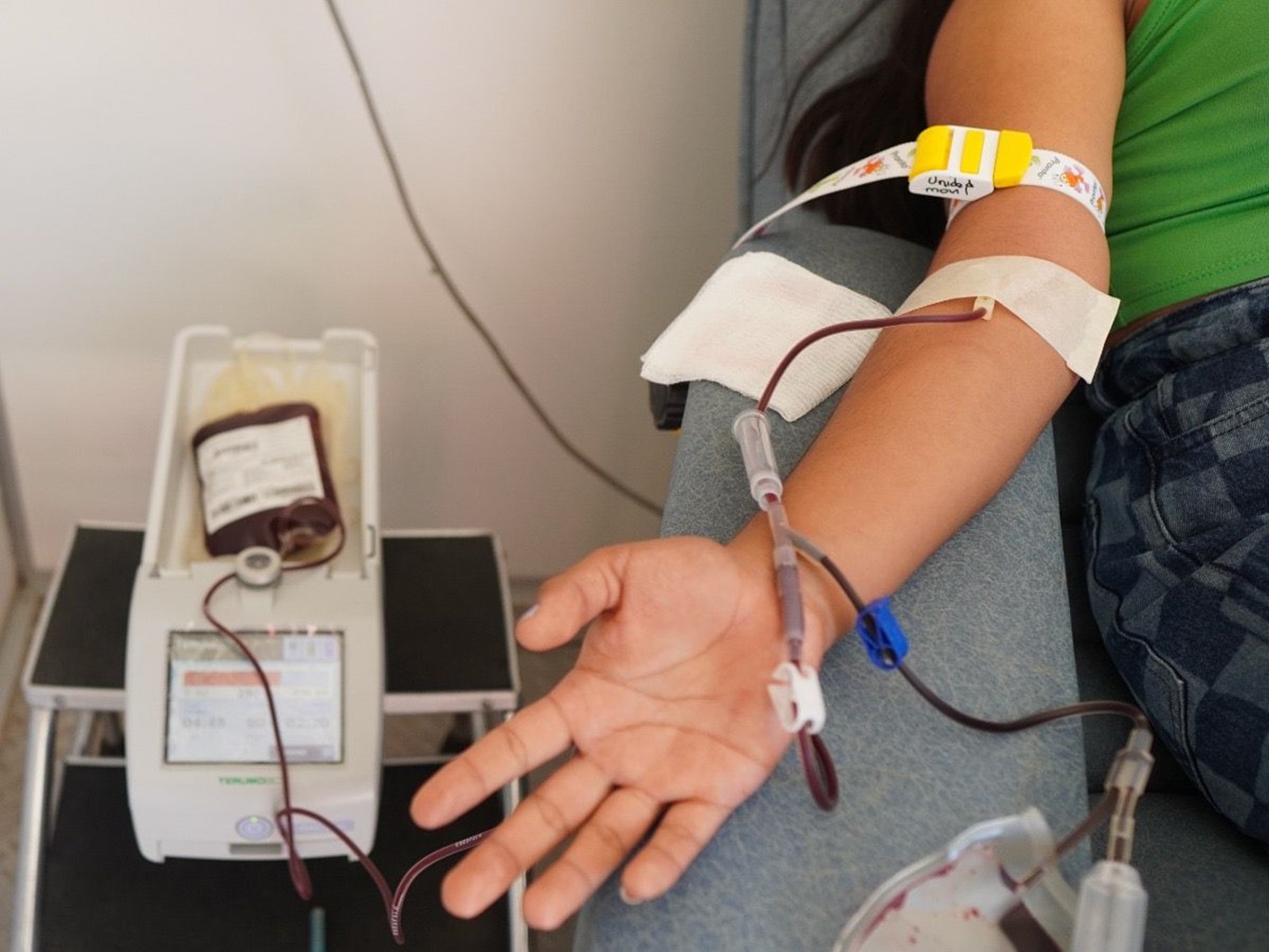 Hemofilia afecta a una de cada 10 mil personas