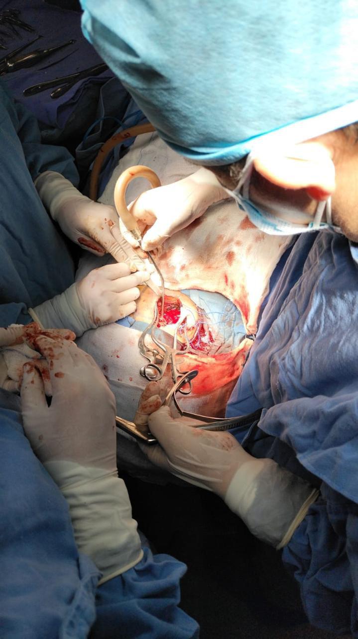 Realizan cirugía cerebral de alta complejidad y salvan la vida de joven madre