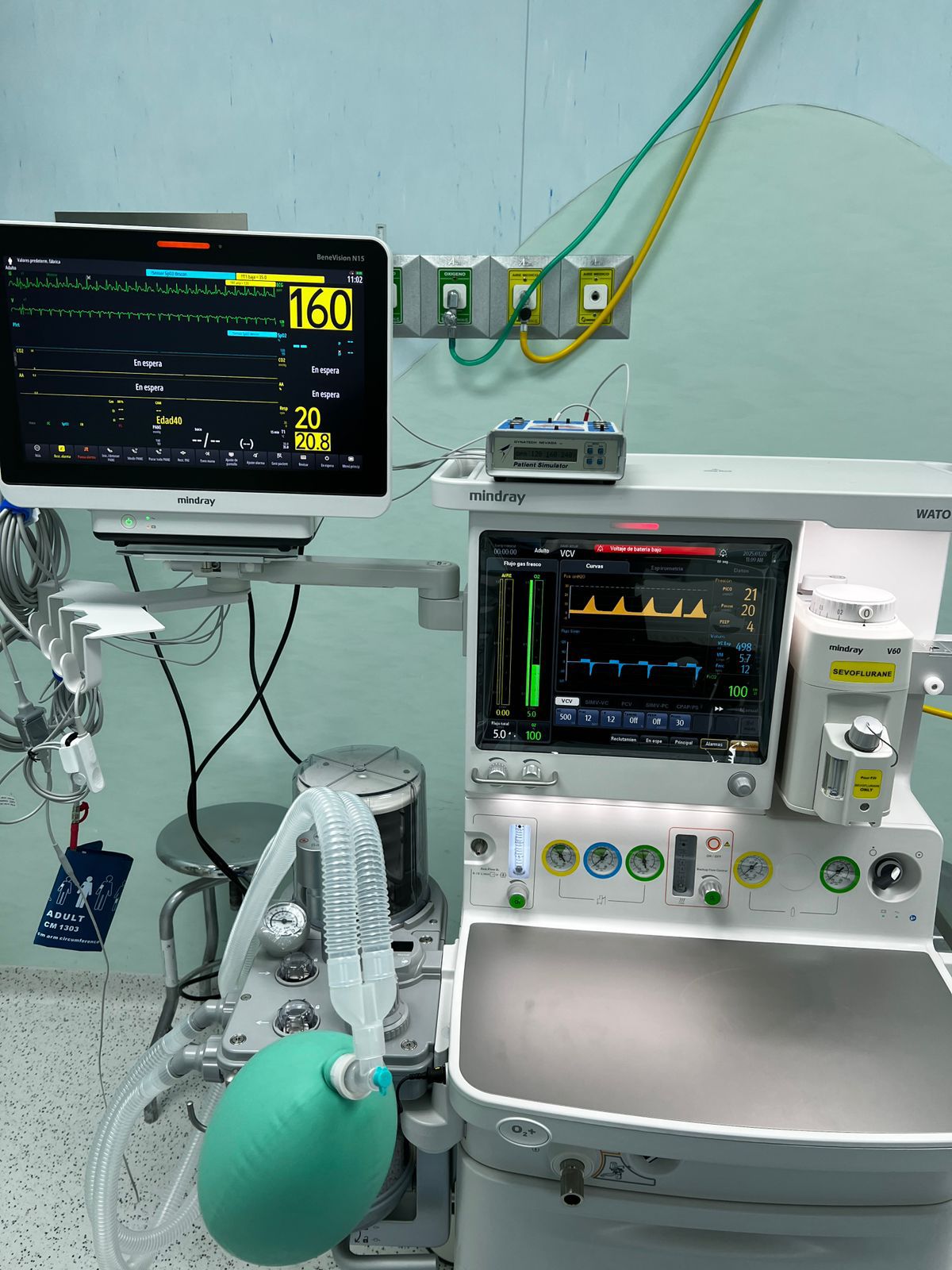 Para realizar cirugías Equipan Hospital de la Niñez Oaxaqueña con tecnología de última generación