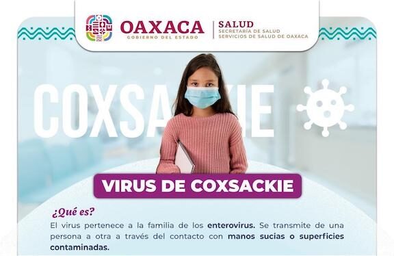 Llama SSO a reforzar hábitos de higiene personal en niñas y niños para prevenir contagios por virus Coxsackie